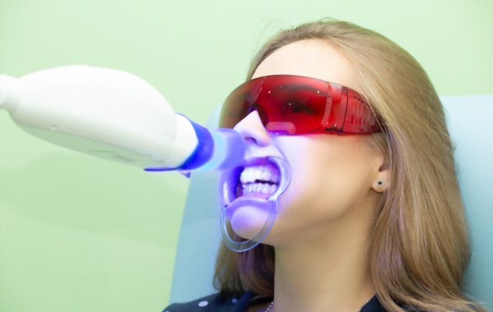 teeth whitening